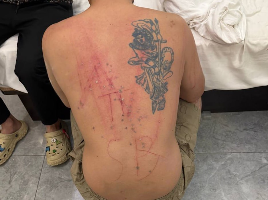 群友爆料:西港一伙绑架犯惨无人道折磨人的视频。