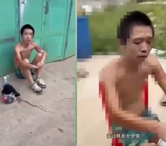 网友柬埔寨经商的华人老板驾车途经街头,偶遇一名浑身伤痕累累的中国流浪小伙。